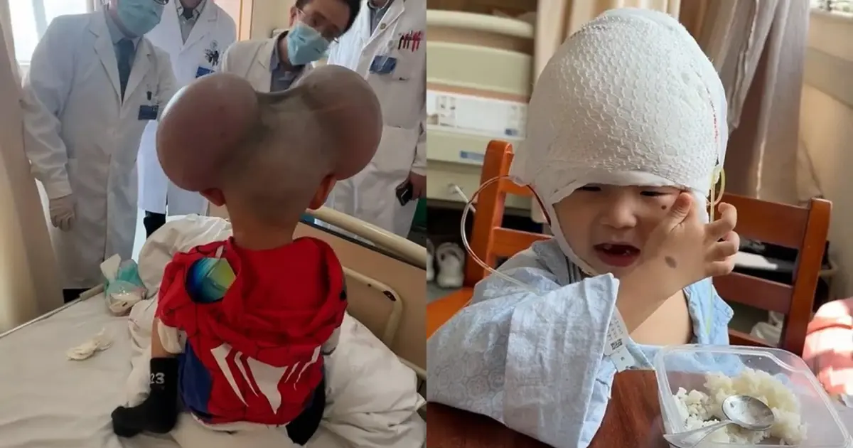 Nốt ruồi của Qibao không chỉ đơn thuần là một dấu hiệu bên ngoài